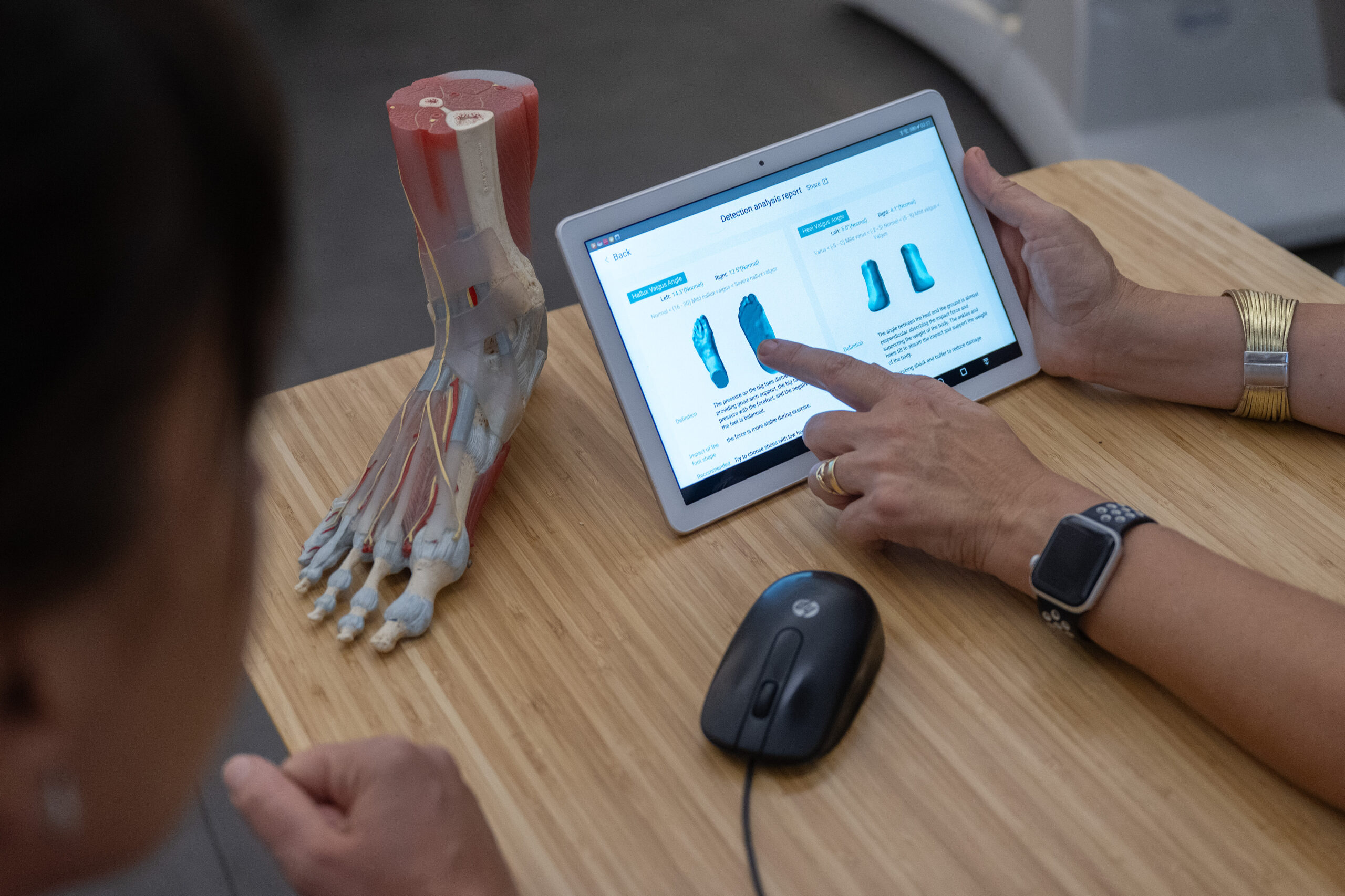 Postprocesado de ortesis 3D para acabado profesional